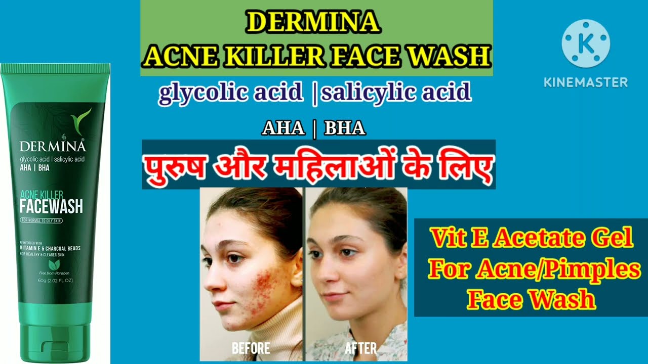 Dermina Facewash//Acne killer Facewash//AHA/BHA Facewash For Normal To Oily Skin//hindi!