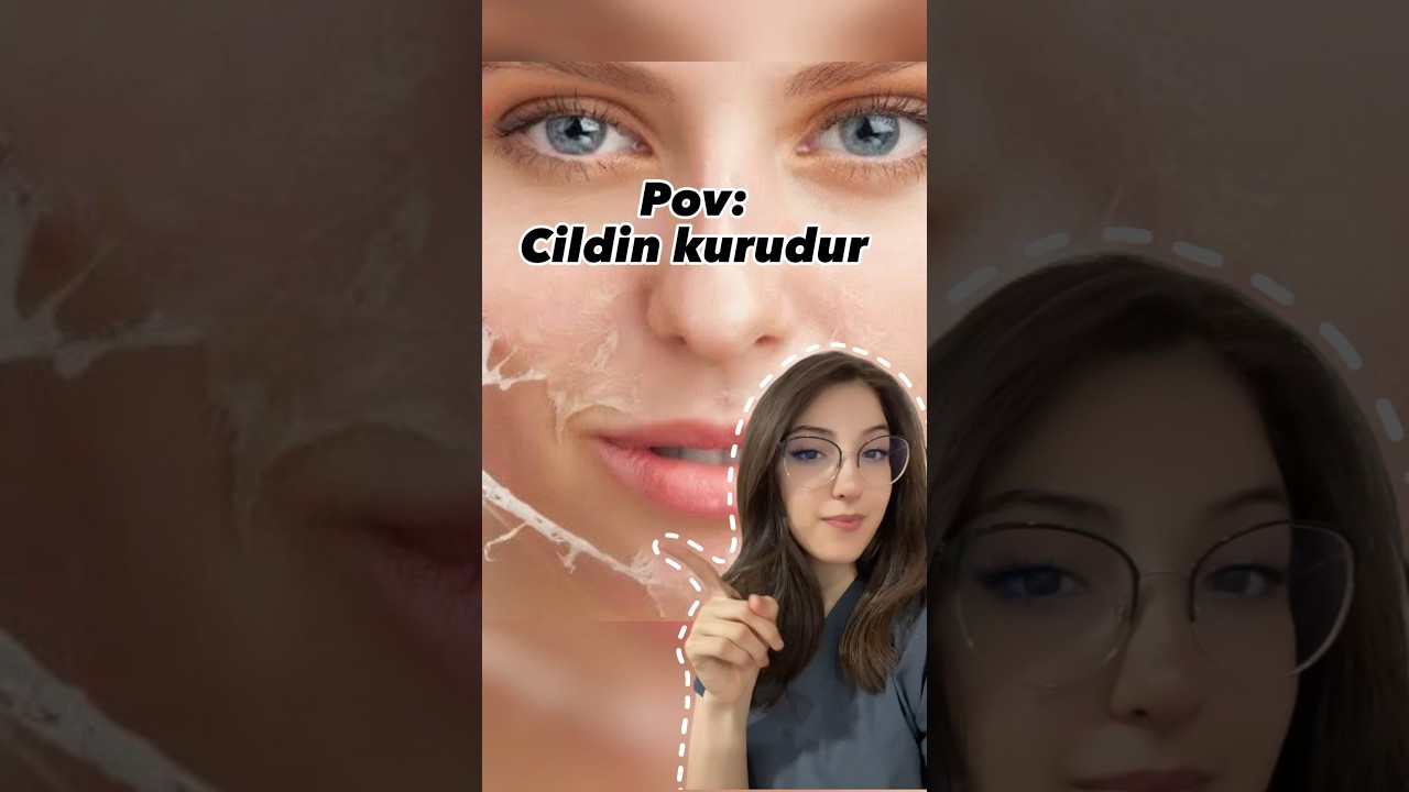 Kuru cilt belirtilerinden bazıları. Kuru cilt bakım videosu i&ccedil;in takipte kalın✨ #keşfetbeni&ouml;ne&ccedil;ıkar