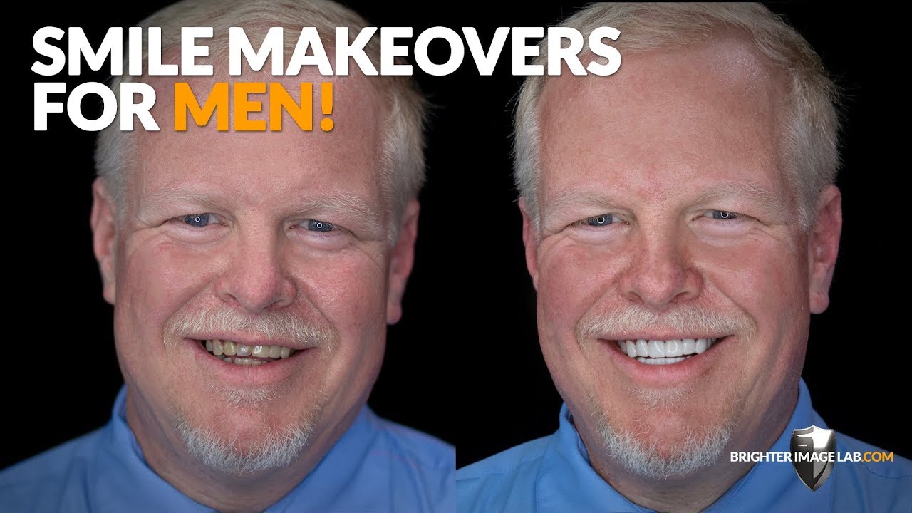 Smile Makeovers для мужчин! Стоматологические виниры Incredibil &trade; от Brighter Image Lab!