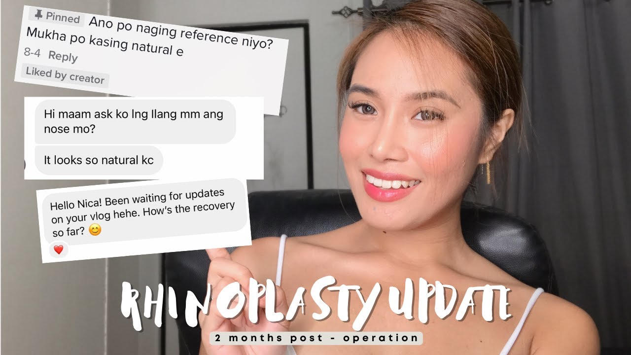 RHINOPLASTY UPDATE: 2 months Post OP and Q + A | Nica Ibit
