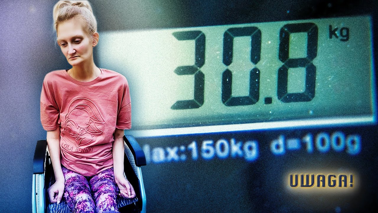 Uważała, że jest za gruba, dziś jest przykuta do ł&oacute;żka. Poruszająca historia Olgi (UWAGA! TVN)