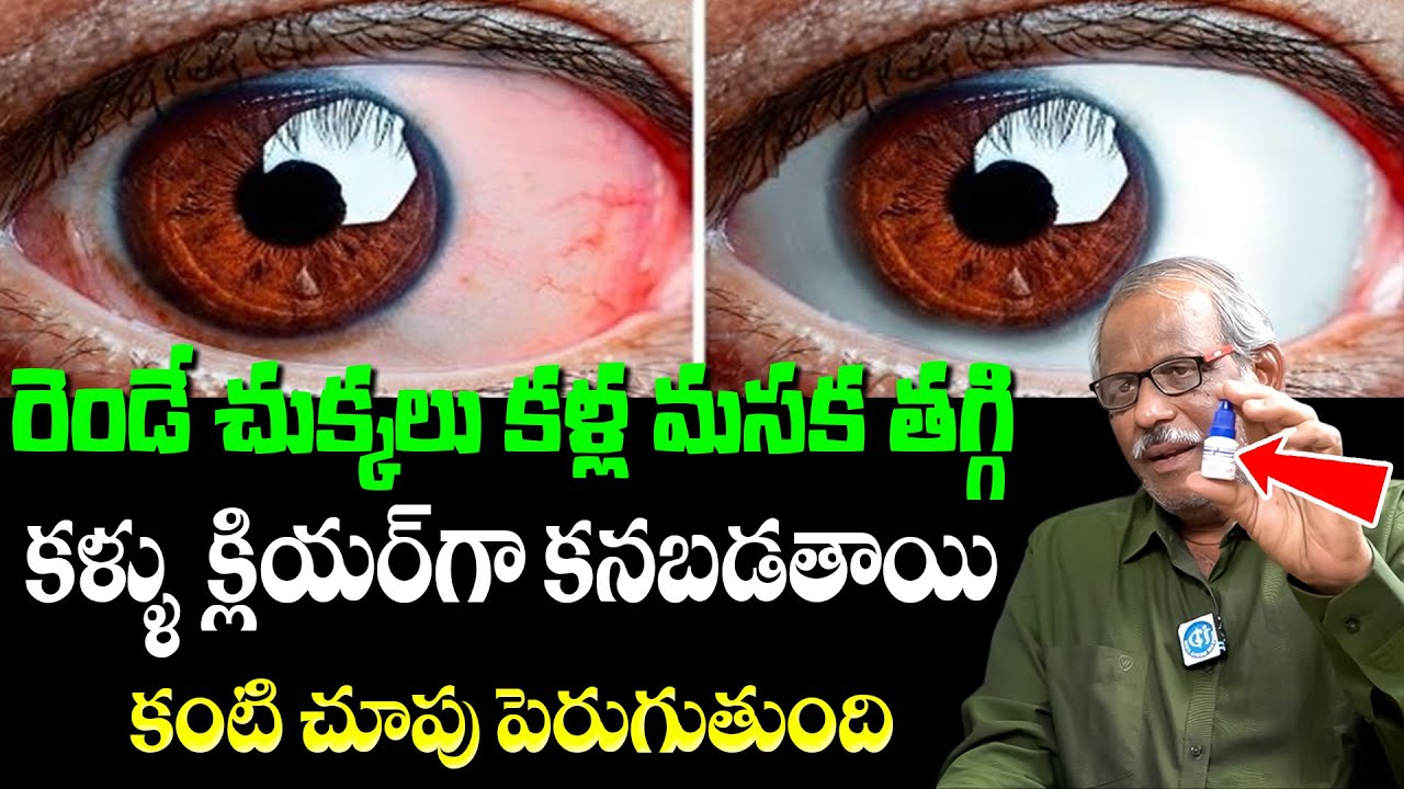 రెండే చుక్కలు కళ్ల మసక తగ్గి కంటి చూపు పెరుగుతుంది  | Eye Power is Came Back | Balakishan | iDream
