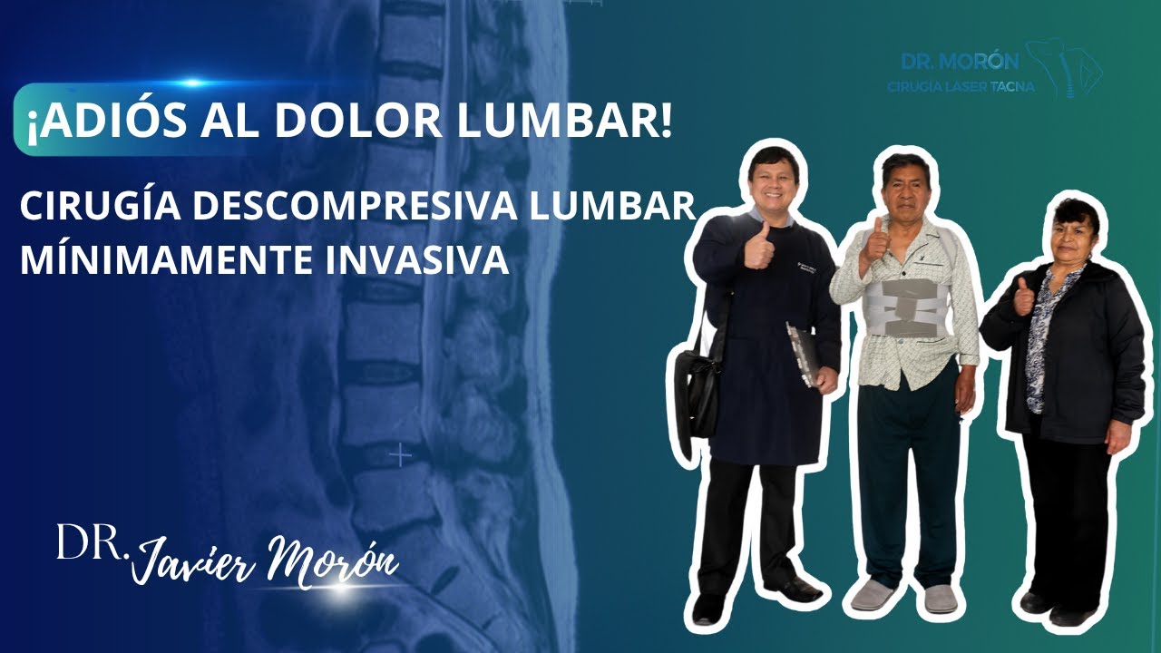 &iexcl;ADI&Oacute;S al DOLOR LUMBAR! Caso Real de Descompresi&oacute;n Lumbar M&iacute;nimamente Invasiva | Paciente despierto
