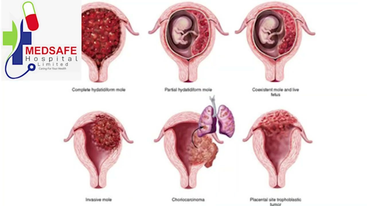 Understanding Ultrasound Scans, Why Every Mom Needs One
