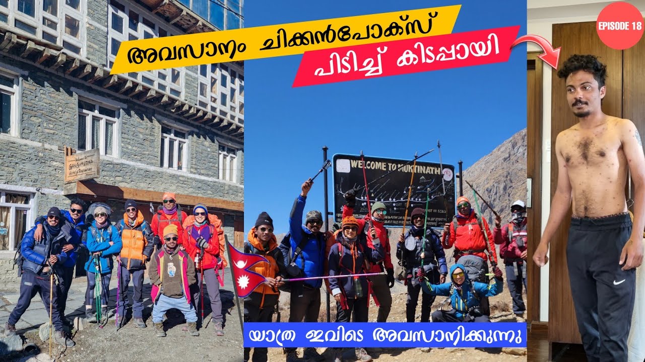 EP18 - ട്രക്കിങ്ങിന്റെ അവസാനം Chickenpox😇Annapurna Trekking ഇവിടെ അവസാനിക്കുന്നു