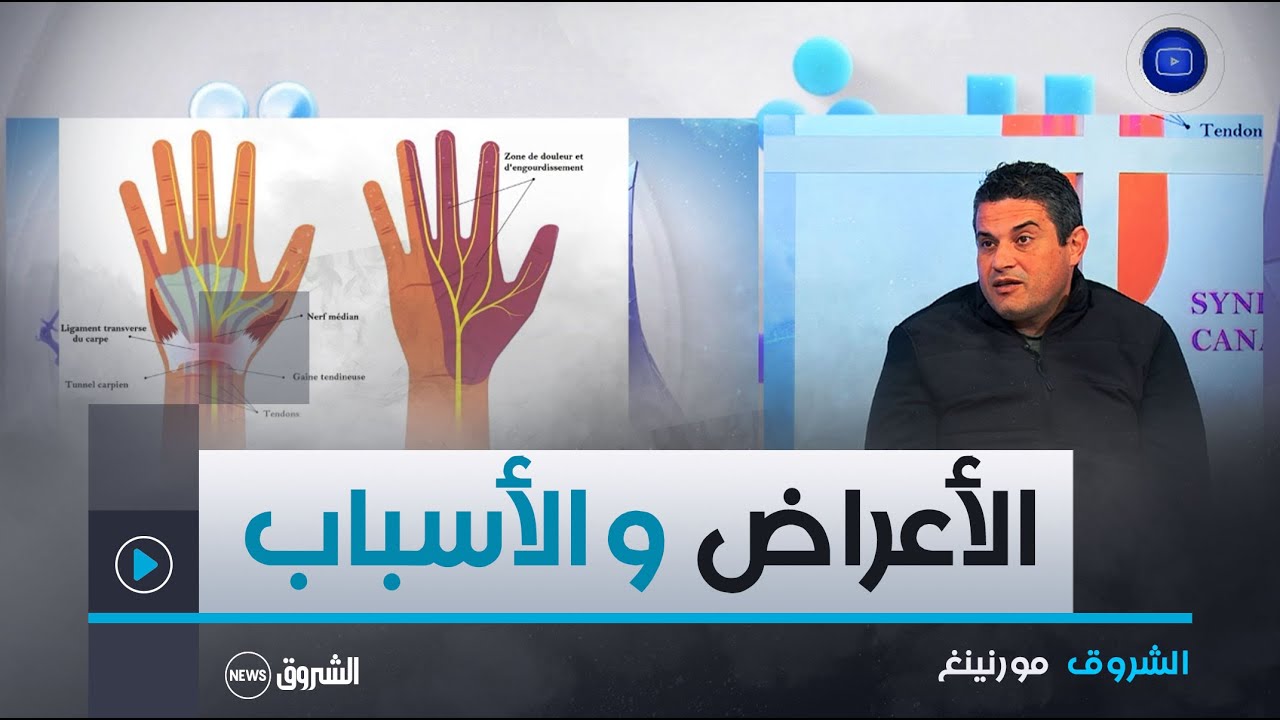 الشروق مورنينغ| متلازمة النفق الرسغي.. الأسباب و الأعراض و الدواعي الجراحية