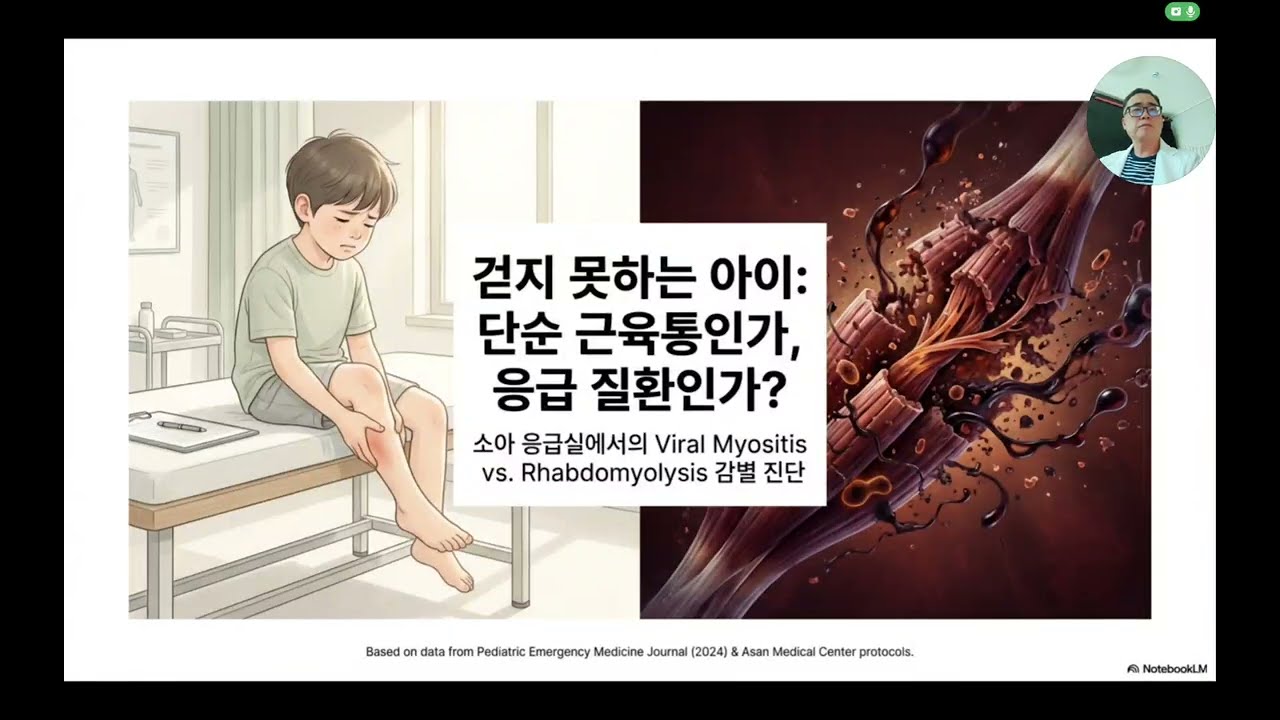 독감 후 아이가 못 걷는다? 근육통일까? 혹시 횡문근융해증은 아닐까?