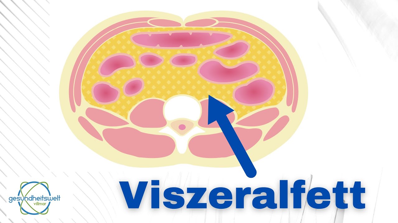 Viszeralfett - Tiefes Bauchfett loswerden!