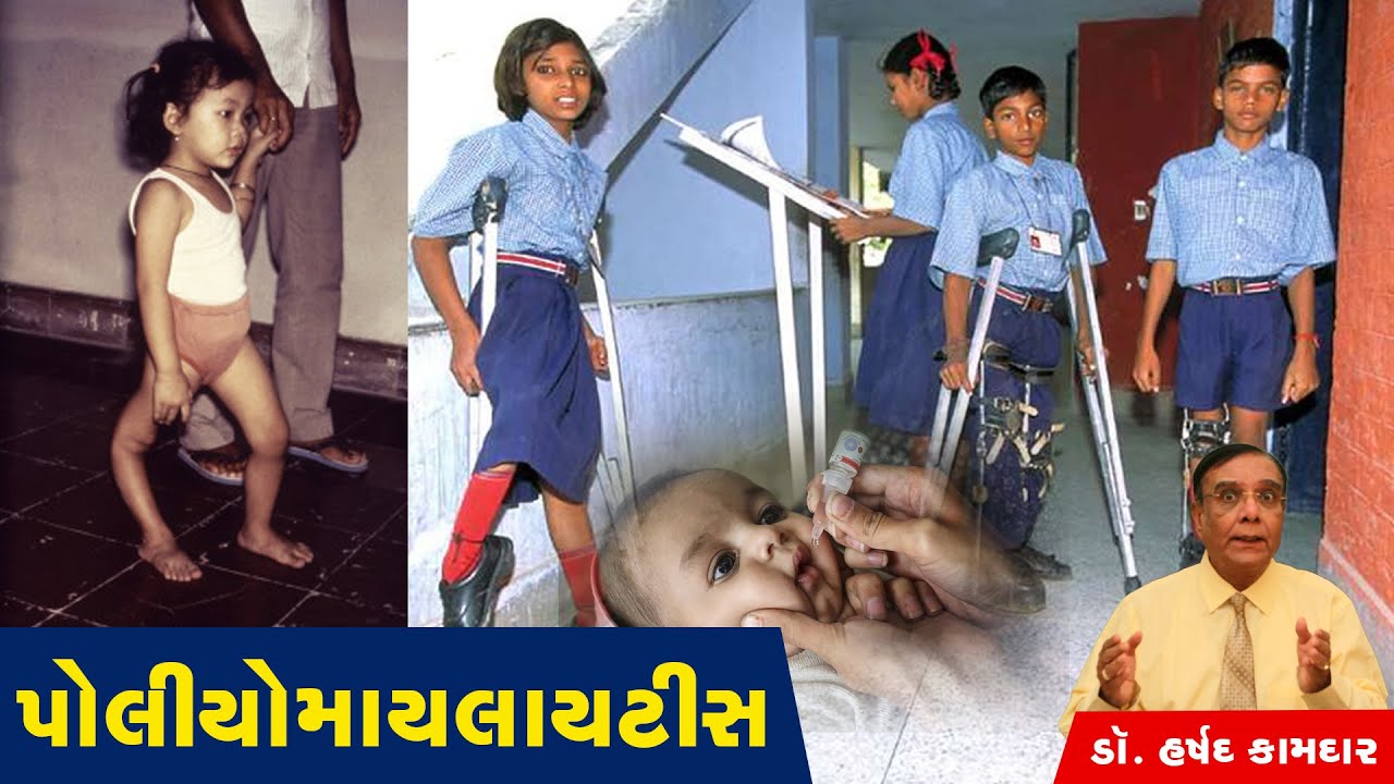 પોલીયોમાયલાયટીસ || Poliomyelitis  || Dr. Harshad Kamdar ||  ડૉ. હર્ષદ કામદાર