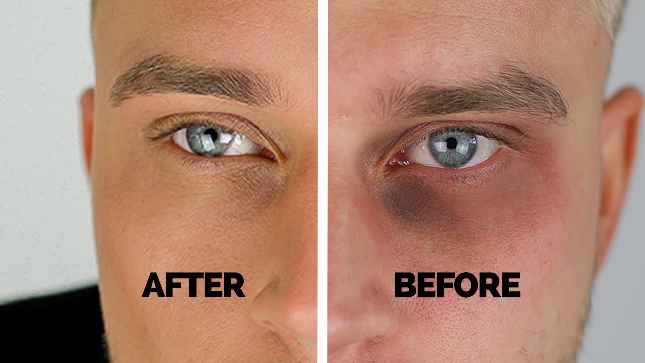 How To Cover Dark Circles Under Eyes | Easy Step by Step Guide