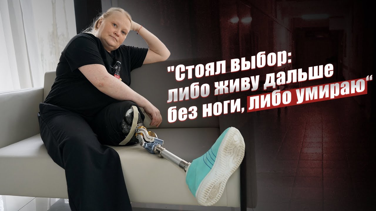 Ампутация. Оказалось это не так страшно: Светлана | История пациента INSTEP