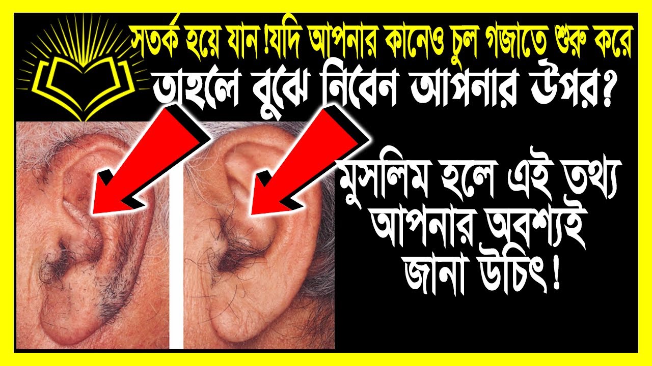 কানের লোম বেশী থাকলে কি ঘটবে আপনার জীবনে!জেনে নিন!