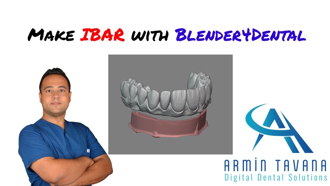 Make IBAR with Blender4Dental