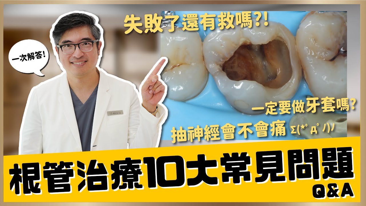 【蛀牙 #7】根管治療10大常見問題大公開！抽神經會不會痛？抽完神經還會痛正常嗎？根管治療後一定要做牙套嗎？一般根管治療與顯微根管治療有什麼差別？｜【祐民牙醫－隱適美旗艦店】鑽石級楊大為醫師