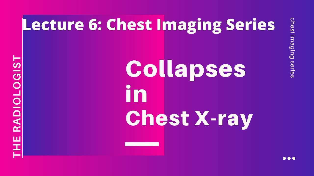 COLLAPSE IN CHEST X-RAY (Module 1) - CHEST IMAGING SERIES (LECTURE 6)