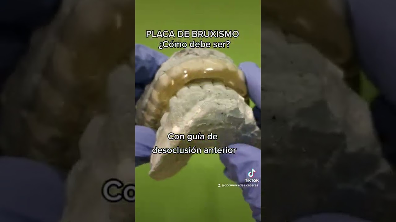 Caracter&iacute;sticas de una PLACA MIORRELAJANTE