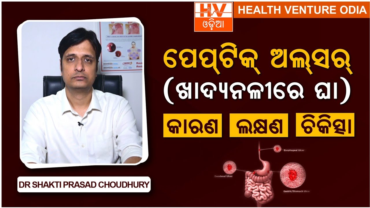 ପେପଟିକ୍ ଅଲସର୍: କାରଣ,ଲକ୍ଷଣ ଓ ଚିକିତ୍ସା// Dr Shakti Prasad Choudhury on Peptic Ulcer in Odia
