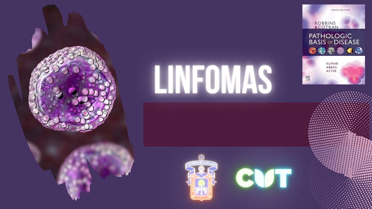 Linfomas - curso 2022A
