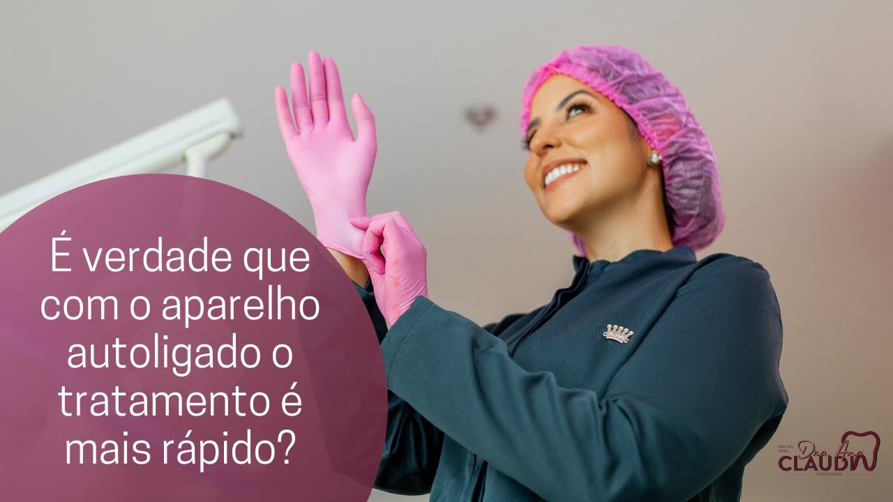 O aparelho autoligado é o aparelho mais rápido?