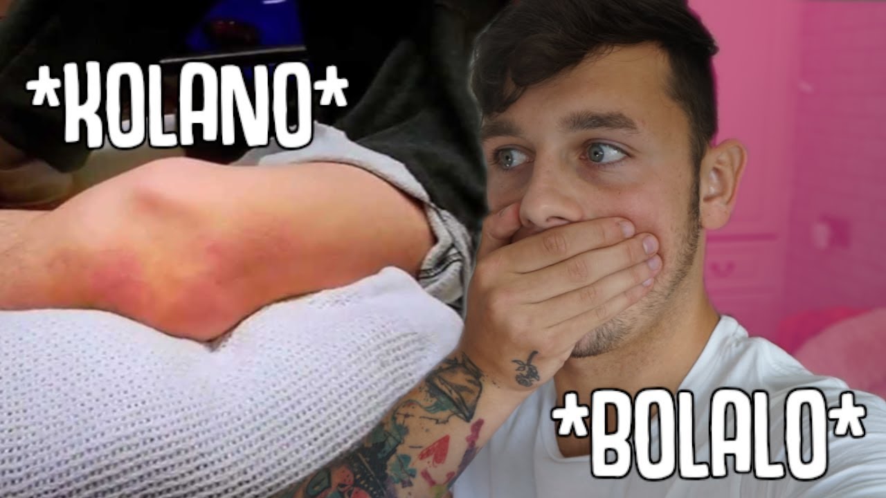 KONTUZJA KTÓRA ZAKOŃCZYŁA MOJĄ KARIERE *EMOCJONALNE*