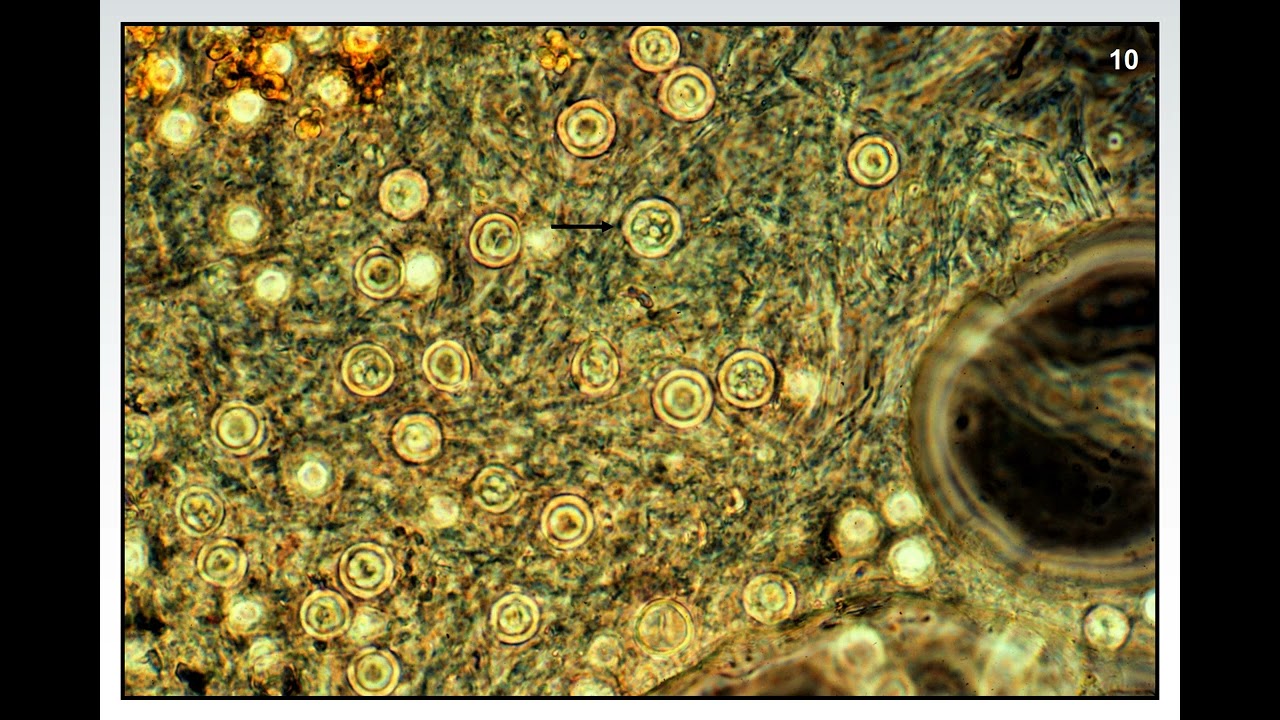 Fundamentals of Plant Diseases - Slide 10 - FUNGI:  RESTING SPORES