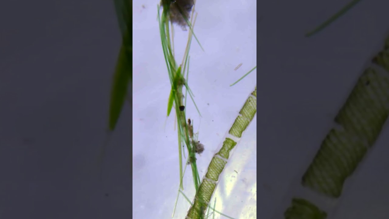 Algae Under a Microscope