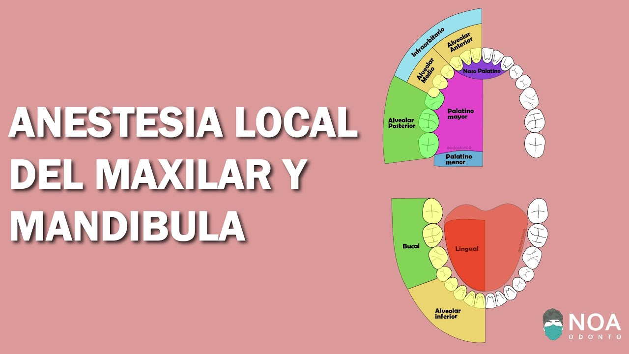 Rama Maxilar y Mandibular para Anestesia Local en Odontología
