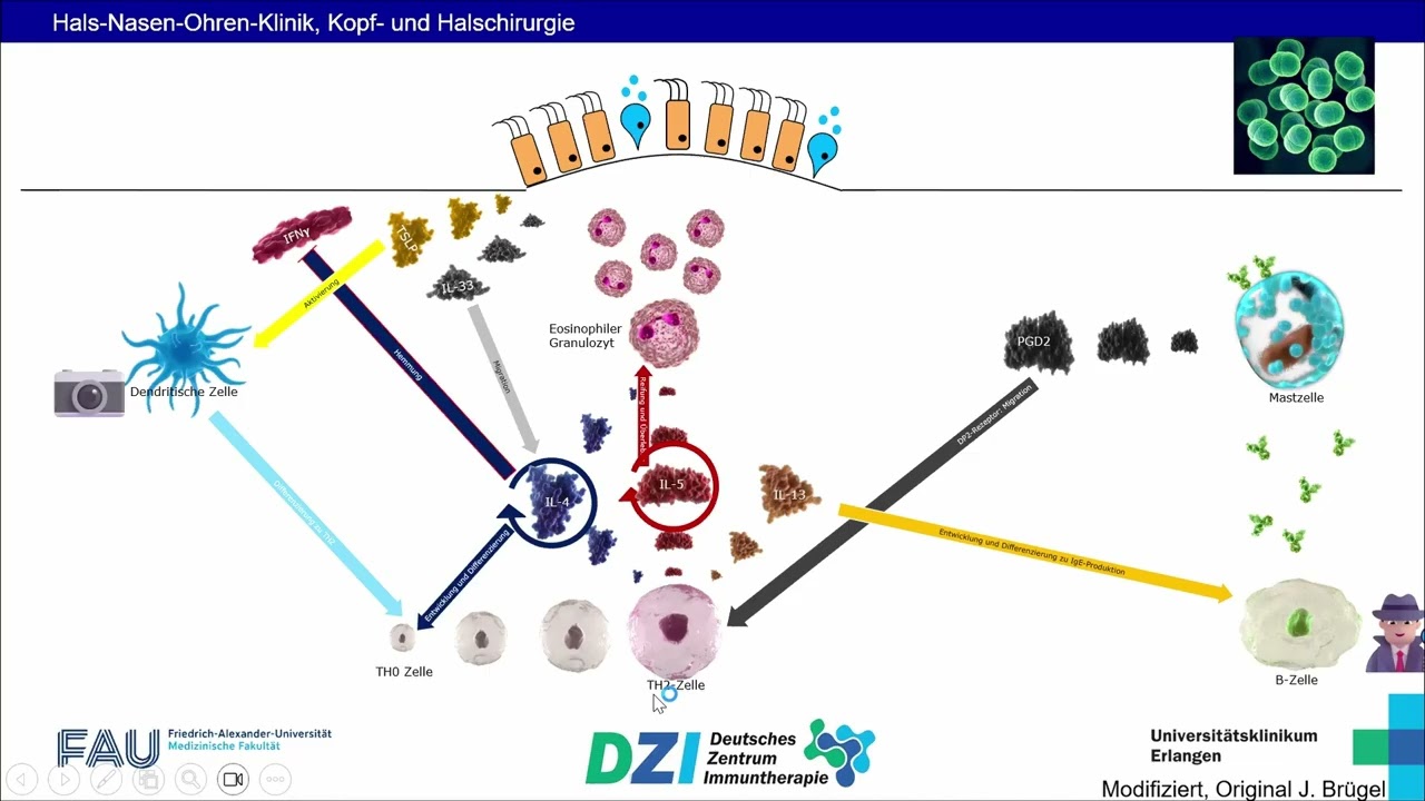 DZI-Webinar: Immuntherapie bei der chronischen Nasennebenhöhlenentzündung, 10.12.2025