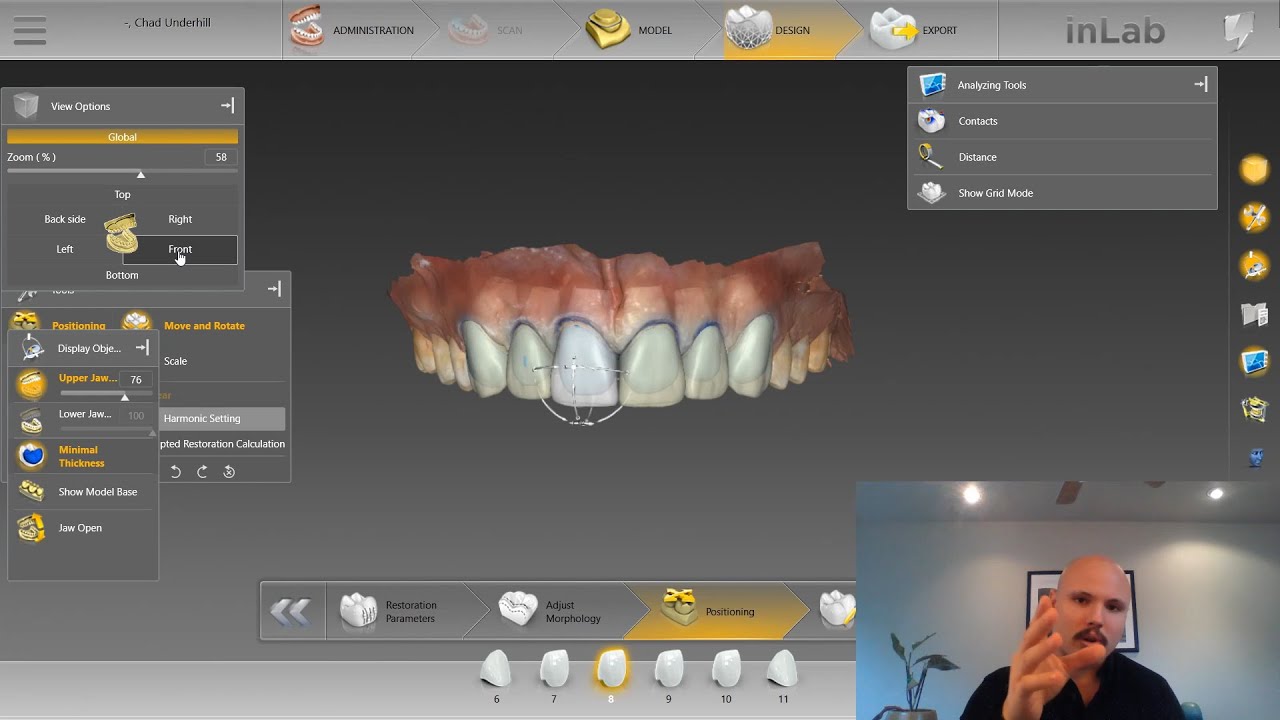 How To: Design CEREC smile