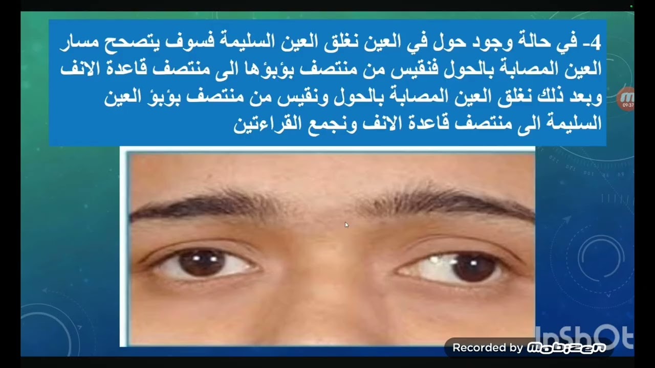 Medical Glasses - Inter Pupillary Distance (IPD).