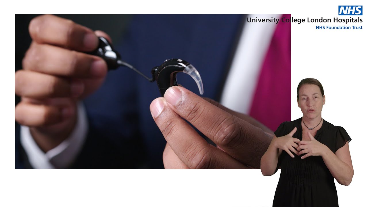 Cochlear implant journey | From assessment to activation | with BSL