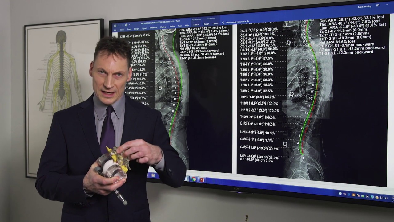 Chiropractic Adjustments/Joint Mobilization Explained