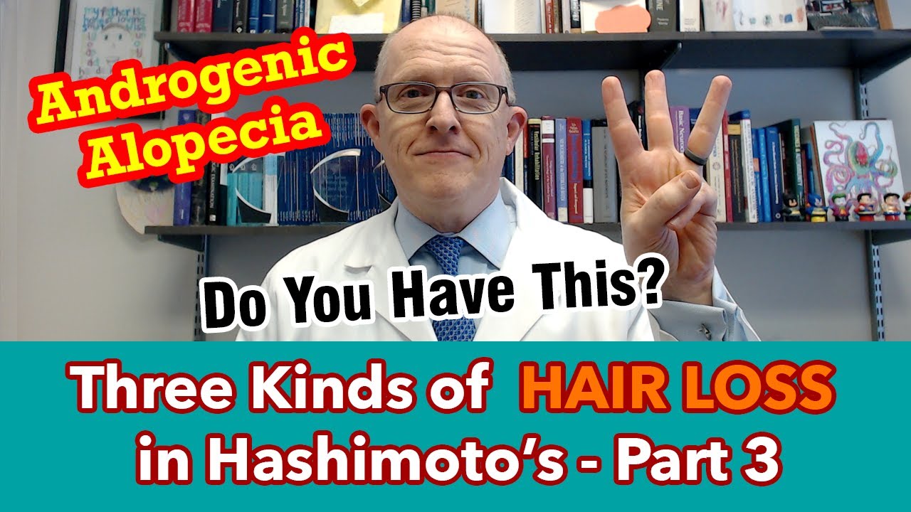Three kinds of Hashimoto's Hair Loss - Part 3 - Androgenic Alopecia (DHEA, Testosterone)
