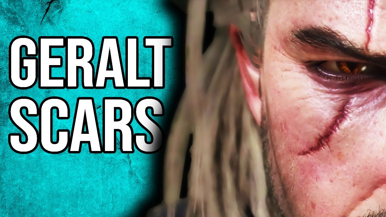 Witcher 3 Geralt's Scars