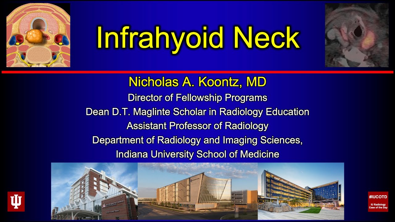 Infrahyoid Neck
