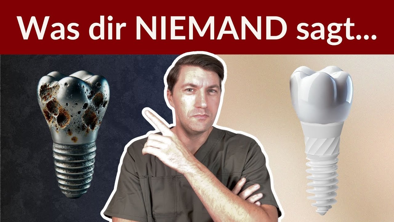 Titanimplantate: Die ganze Wahrheit (und warum ich sie nie wieder setze)