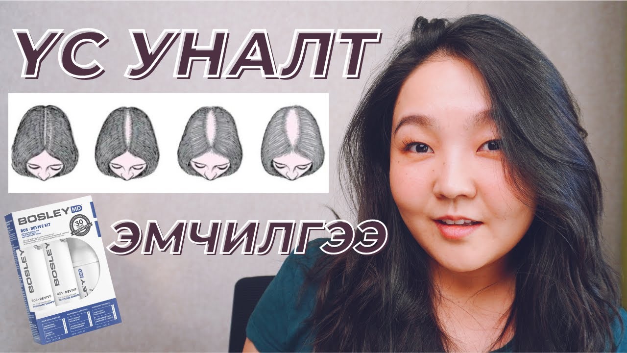Үс уналтын тухай: Шинж тэмдэг, нөлөөлөгч хүчин зүйлс болон эмчилгээ (BosleyMD)