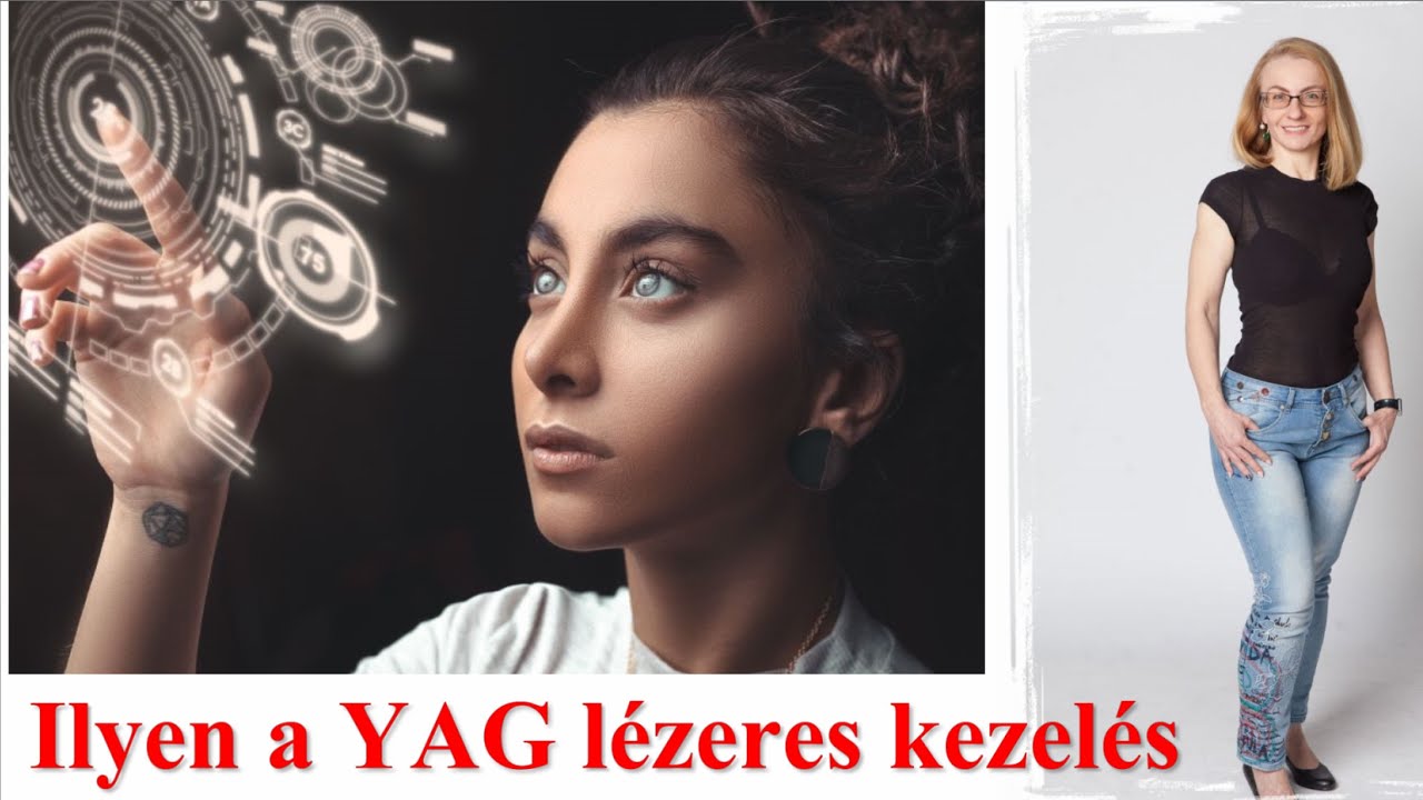 YAG lézeres kezelés lencsebeültetés (tokzsugor) után - a teljes folyamat
