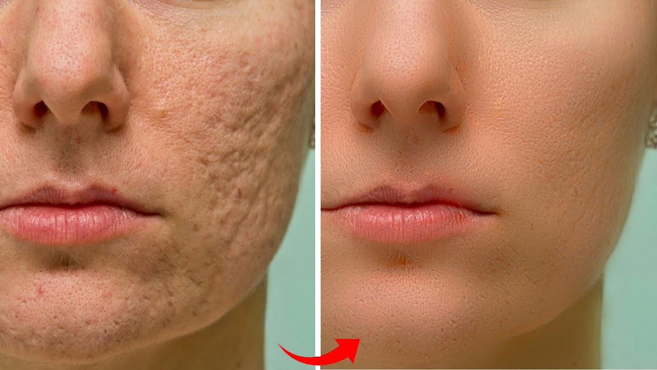 High End Skin Retouching Within 1 Minute in Photoshop