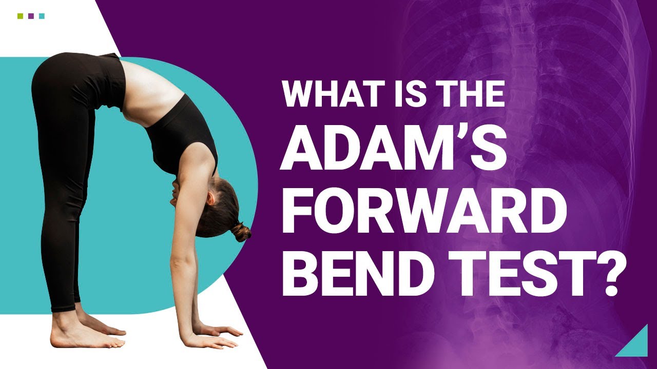 What is the Adam's Forward Bend Test?