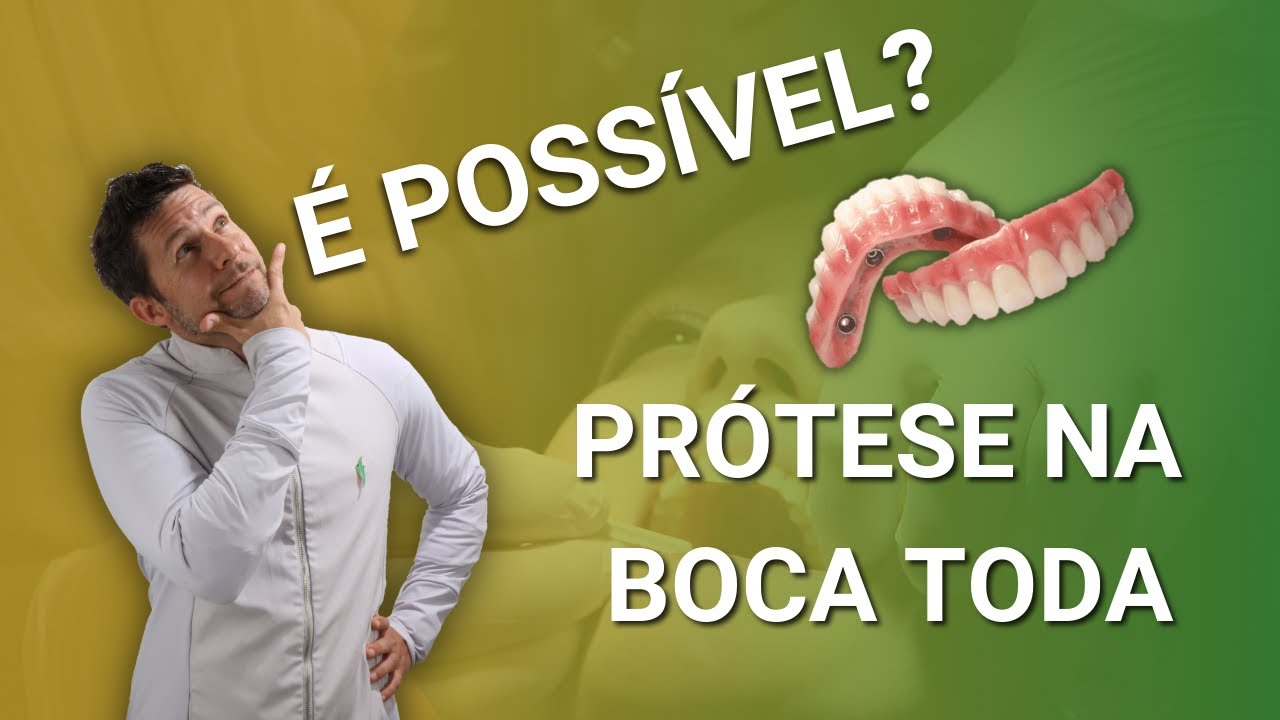 Como Funciona Implante Na Boca Toda?