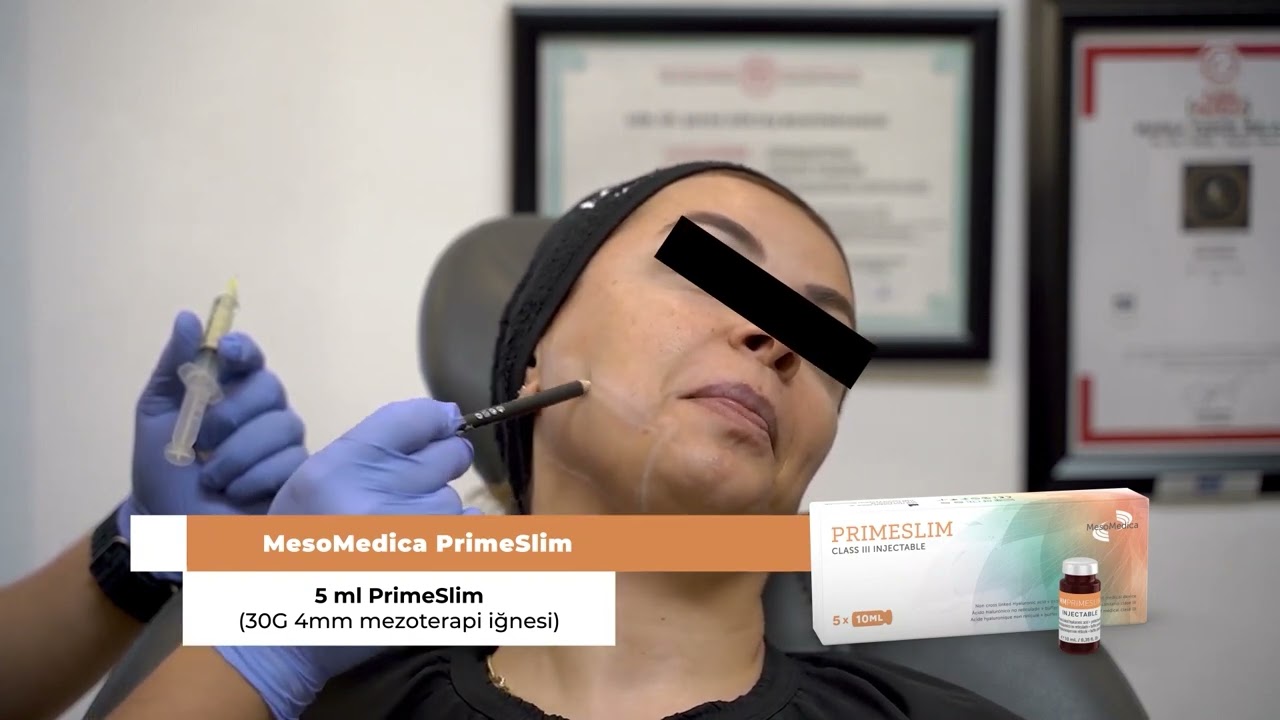 Enzimatik Lipoliz, PrimeSlim & Cellulysis ile Yüz ve Vücut Şekillendirme / Dr. Şafak Göktaş