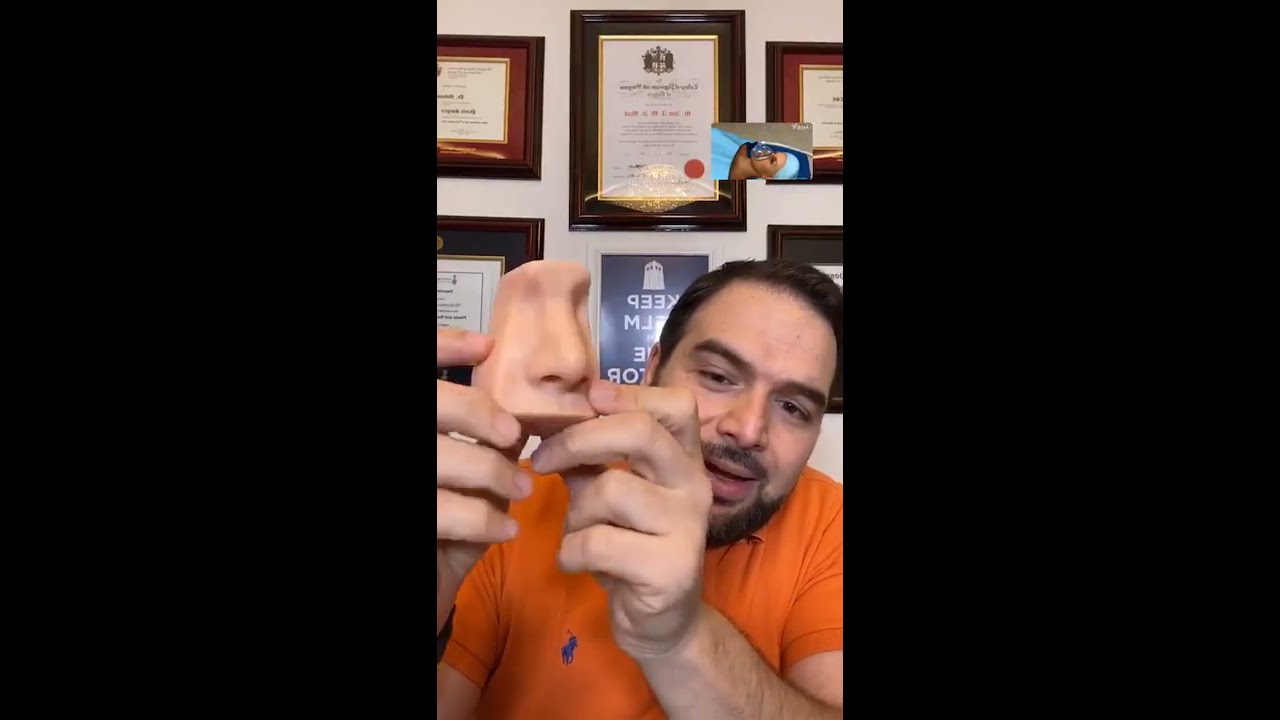 حلقة كاملة عن تجميل الأنف مع الدكتور أمير مراد