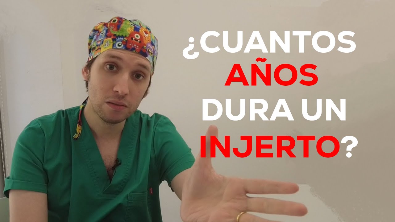 ¿Cuántos AÑOS dura REALMENTE un INJERTO de PELO?