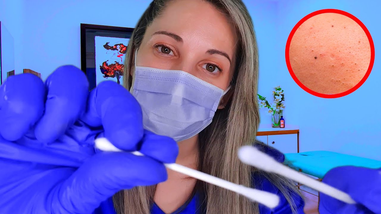 Clínica ASMR | Extracción satisfactoria de Sebo | RP Médico | SusurrosdelSurr
