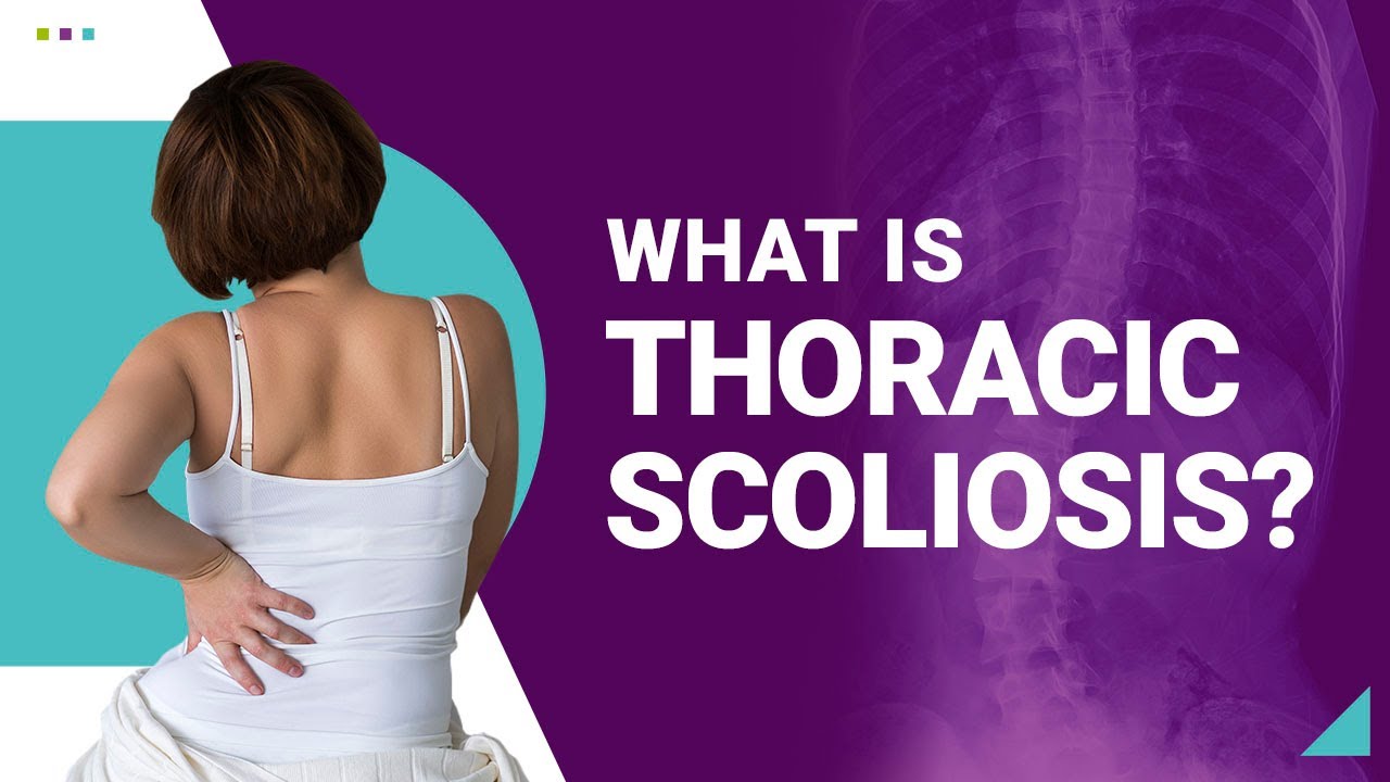 What is Thoracic Scoliosis?