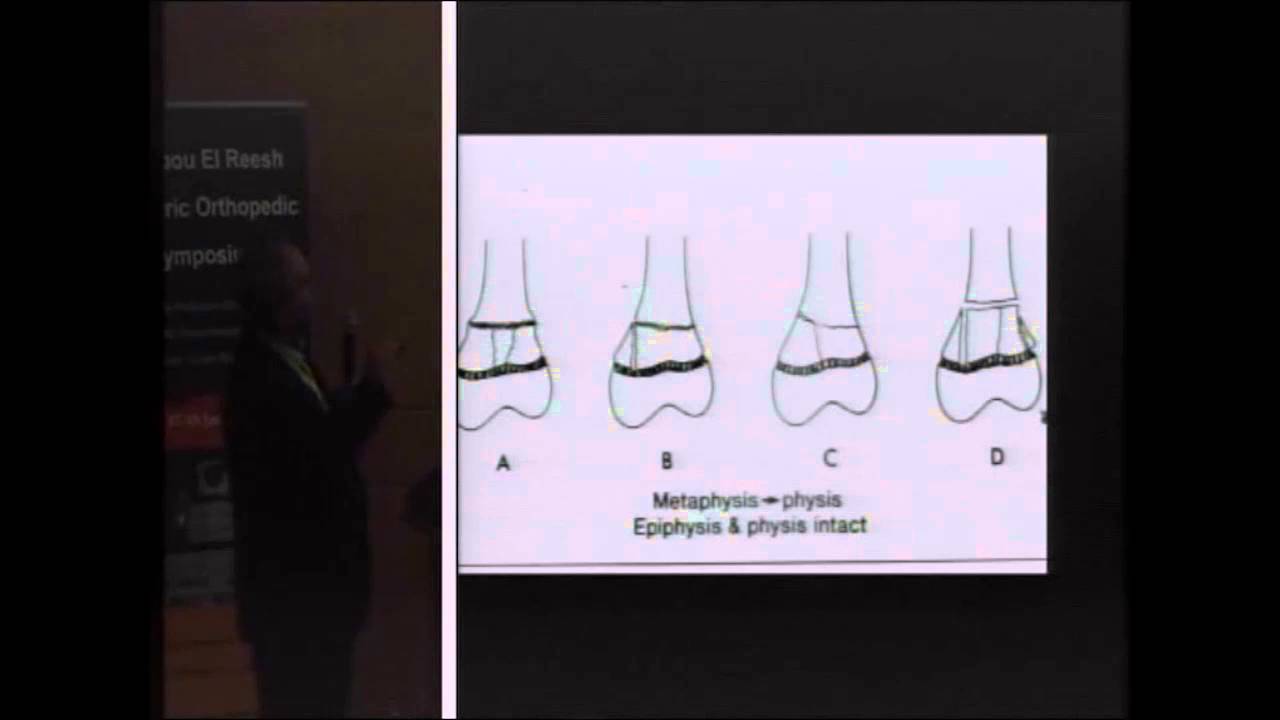 Physeal Injuries