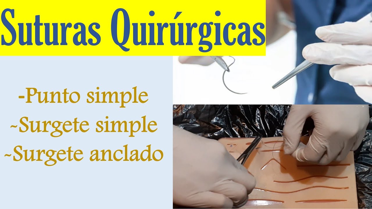 PUNTO SIMPLE, PUNTO DE SUTURA CONTINUO SIMPLE (SURGETE SIMPLE) Y PUNTO DE SUTURA ANCLADO.