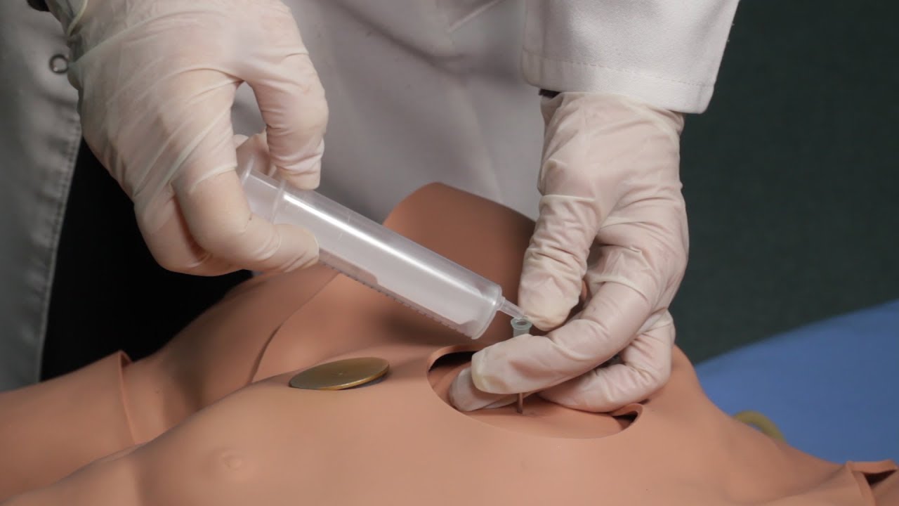 Техника выполнения экстренной плевральной пункции