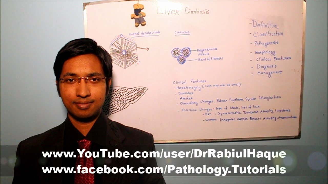Liver Cirrhosis : Part 2 (HD)